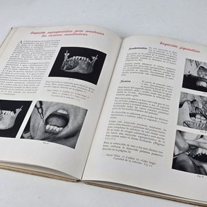 Manual de Anestesia Local en Odontología y Molde Dental - imagen 8